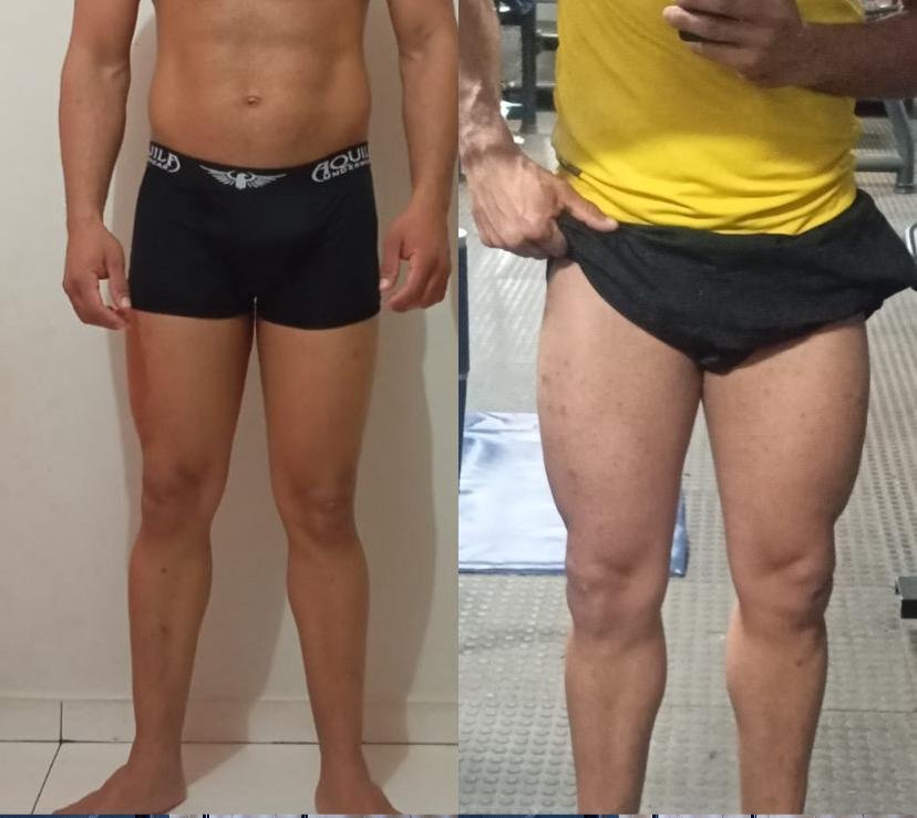 Depoimento antes e depois