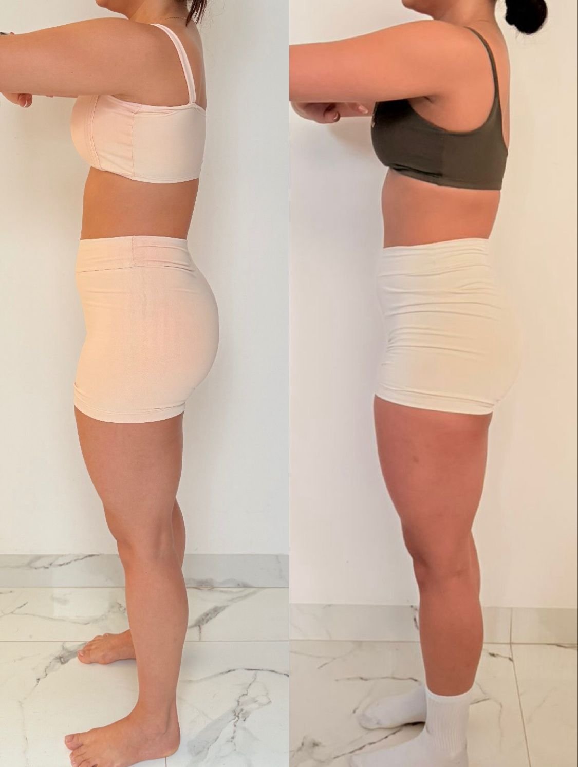 Depoimento antes e depois